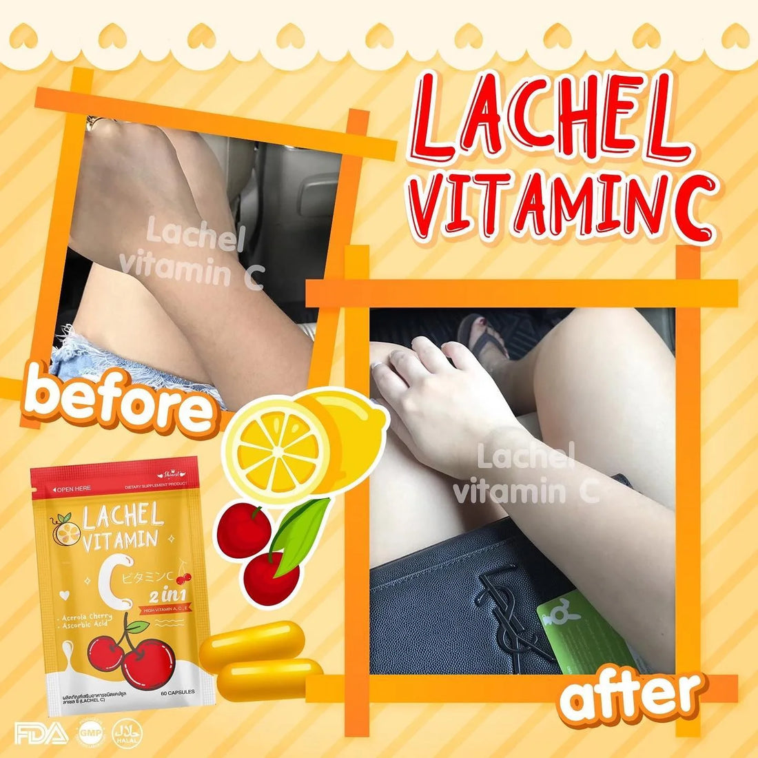 Lachel Vitamin C | Radiant Skin , Immunity & Beauty